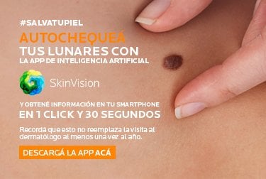 LRP_SALVA-TU-PIEL_BANNER-SKIN-VISION_MOBILE_op2_414X517_2_11zon